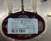 Transfusao Sanguinea Em Caes e Gatos- (3)