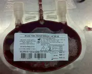 Transfusao Sanguinea Em Caes e Gatos- (3)